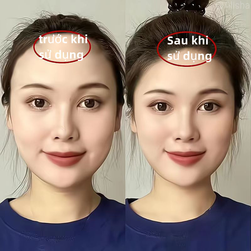Dầu dưỡng tóc tinh dầu chăm sóc tóc Tinh chất mọc tóc Tinh chất gừng tươi Chống rụng tóc 30ml nước dinh dưỡng tóc gừng