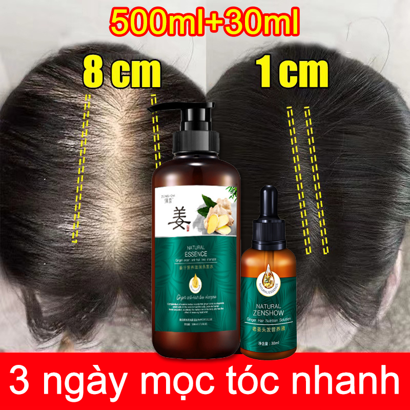 Dầu gội kích mọc tóc Dầu gội chống rụng tóc Dầu gội gừng Dầu gội đầu làm rậm tóc Ngăn rụng tóc và dưỡng tóc Kích thích mọc tóc tươi mát chống dầu gốc tóc vững chắc và tóc khỏe mạnh
