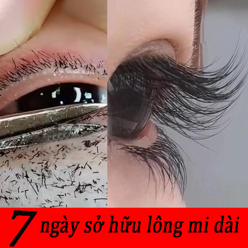 Serum tăng cường mọc lông mi giúp lông mi mọc dài và dày hơn hiệu quả trong 7 ngày 10ml Lông Mi Làm Dày Lông Mi Lông Mày Đường Chân Tóc Mọc Nhanh Tự Nhiên Nuôi Dưỡng Mi Dài Và Cong An toàn hiệu quả và nhanh chóng