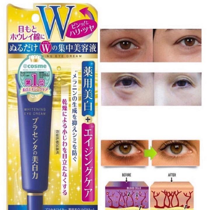 Kem dưỡng mắt Meishoku Whitening Eye Cream 30g