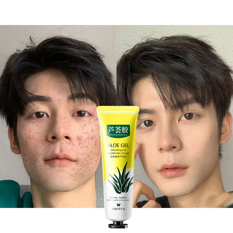 Kem dưỡng da chống mụn Aloe Vera Gel Làm mờ vết thâm Làm trắng da Dưỡng ẩm Kem chống nắng Gentle Repairing 30g