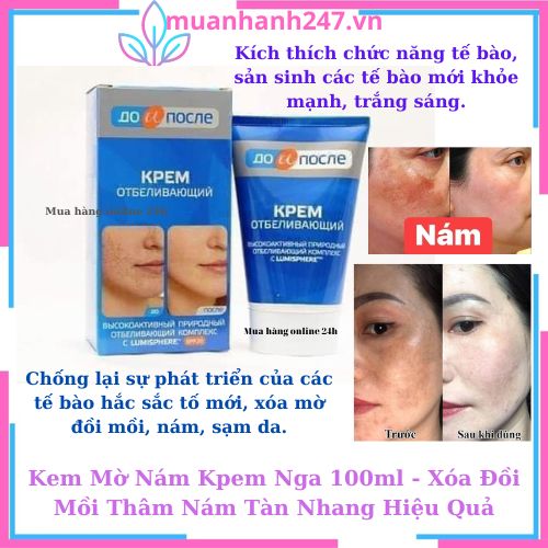 Kem mờ nám kpem nga 100ml - xóa đồi mồi thâm nám tàn nhang hiệu quả