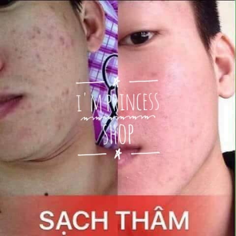 100ml Thảo dược+ tặng son dưỡng gấc