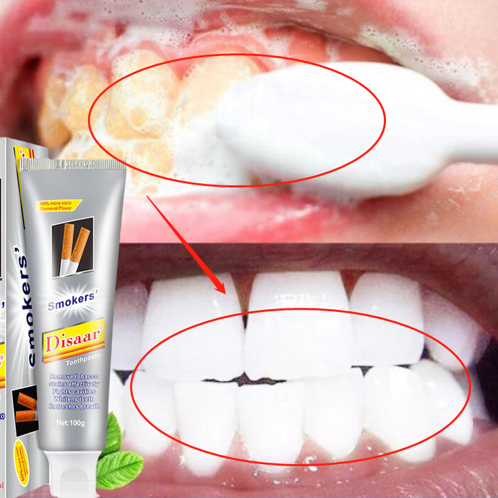 （hiệu quả nhanh.）Chất làm trắng răng để bảo vệ men răng- chăm sóc răng- chất lượng răng-sau khi sử dụng hiệu quả nhanh chóng, Bọt Trắng Răng, Làm Sạch Răng, Khử Mùi Hôi Miệng, Làm Trắng Răng 100g. Làm Trắng Răng .