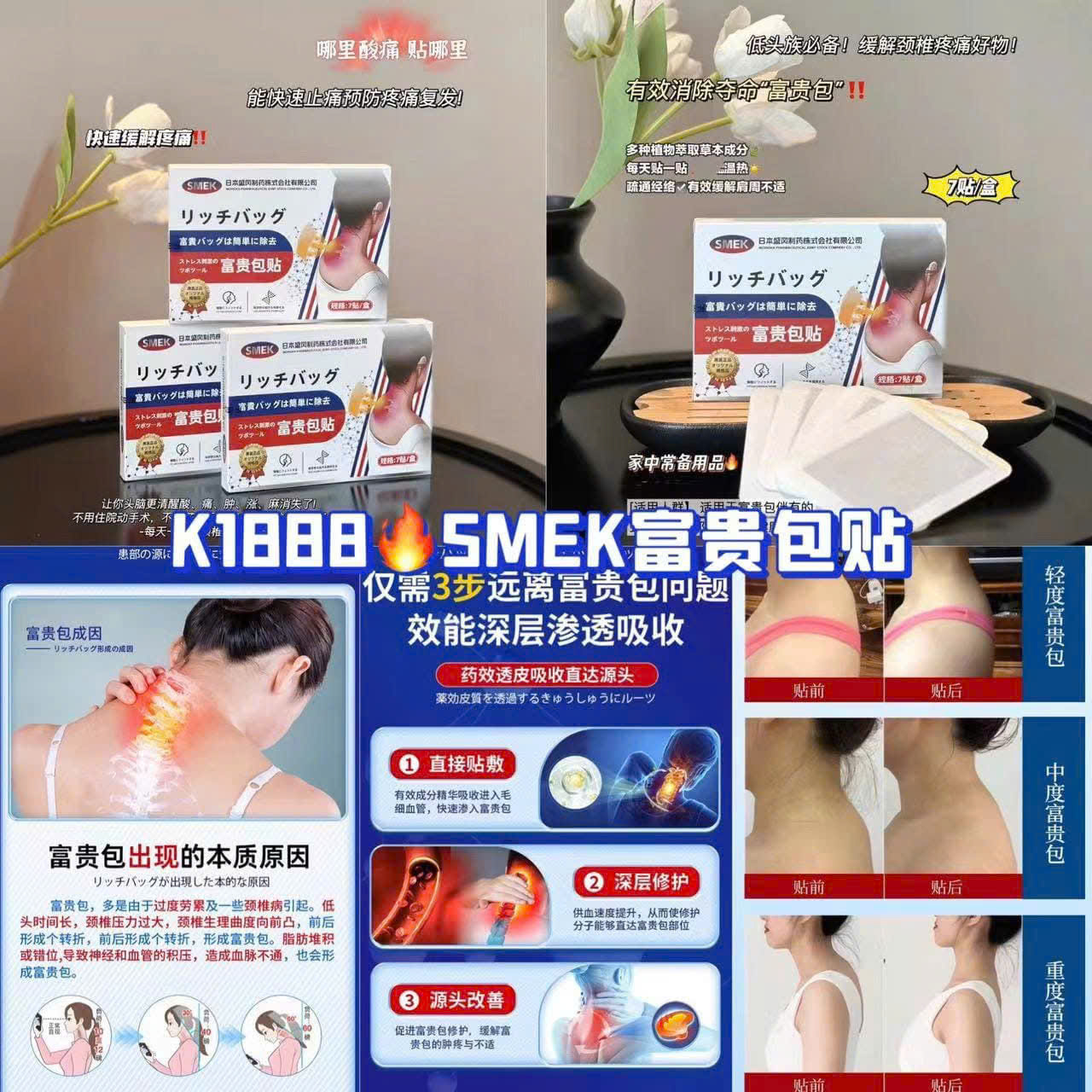 Miếng Dán Giảm Đau Cổ Vai Gáy Lưng Xương Khớp Thảo Dược Thiên Nhiên SIMEK Nhật Bản Hiệu Quả Nhanh