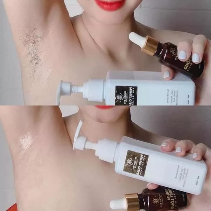 Kem Tẩy Lông Huyền Phi TẶNG serum triệt lông Vĩnh Viễn Triệt Lông chân lông tay lông bikini ria mép an toàn tiện lợi chi phí rẻ