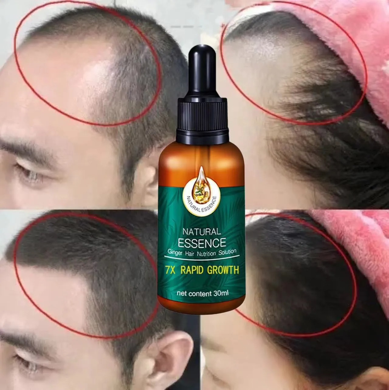 Serum dưỡng tóc,Tinh chất tăng trưởng tóc,tinh chất mọc tóc, Xịt Mọc Tóc Tinh Chất Gừng Tươi Kích Thích Mọc Tóc, giúp giảm rụng tóc, không có tác dụng phụ