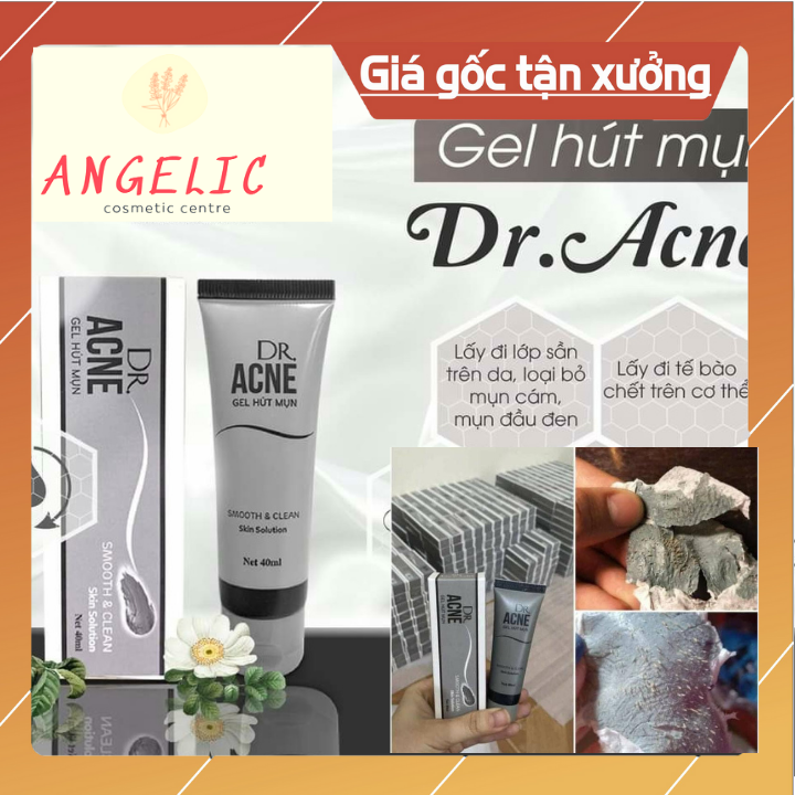 Lột mụn đầu đen acne