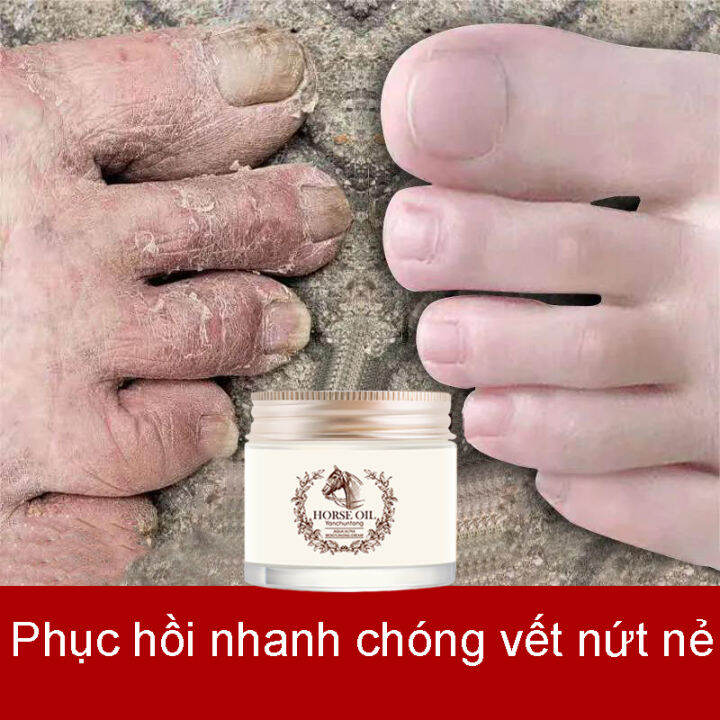 Kem dưỡng mỡ ngựa, kem dưỡng trắng da, kem dưỡng da mặt, bổ sung độ ẩm, Không Bết Rít, Không Gây Kích Ứng, Giúp Dưỡng Trắng Da Từ Sâu Bên Trong, Chống Lão Hóa