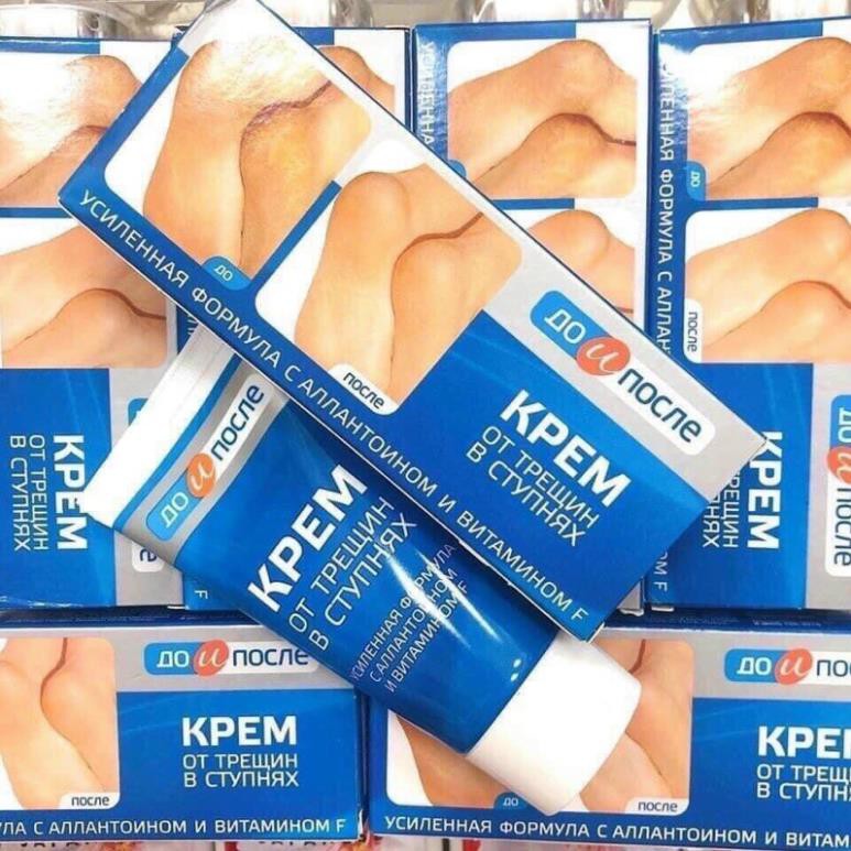 Kem trị nứt gót chân kpem apteka của nga