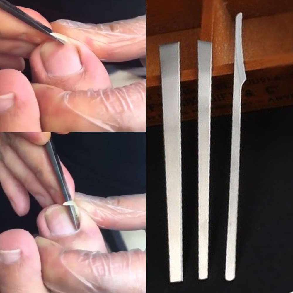 Bộ Dao Lấy Khóe Móng Chân, Lưỡi Dao Sắc Bén Lấy Da Dư Thừa, Vệ Sinh Móng Tay Chân Hiệu Quả, Gọn Gàng, Thiết Kế Nhỏ Gọn Để Đưa Vào Các Góc Cạnh, Cạo Chai Chân, Bảo Đảm Thẩm Mỹ, Gồm 3 Món Đồ Tiện Dụng