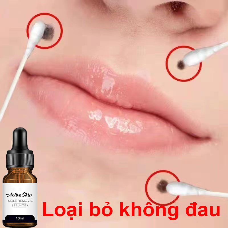 Mole removal serum tẩy nốt ruồi xóa mụn ruồi trên mặt tàn nhang mụn cóc mụn thịt mụn cơm mắt cá tại nhà an toàn và gel mờ sẹo kem ngăn sẹo nga kem ngừa sẹo lồi thâm sẹo rỗ lâu năm các loại sẹo mụn10ml