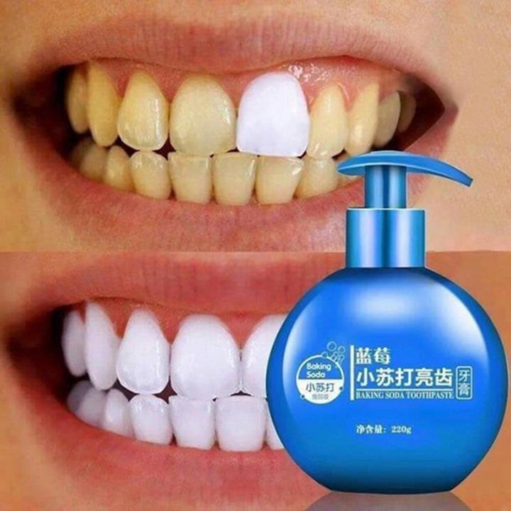 Kem làm trắng răng - kem đánh răng tẩy vết ố vàng , vôi răng baking soda vị hoa quả 220ml