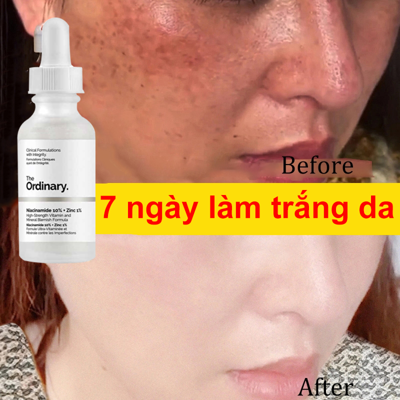 Trắng Da Ngừa Mụn Senana 30ml Trẻ Hóa Da Kiểm Soát Dầu Dưỡng Ẩm,Group Hỗ Trợ Mụn Thanh Lọc da,Thu Nhỏ Lỗ Chân Lông