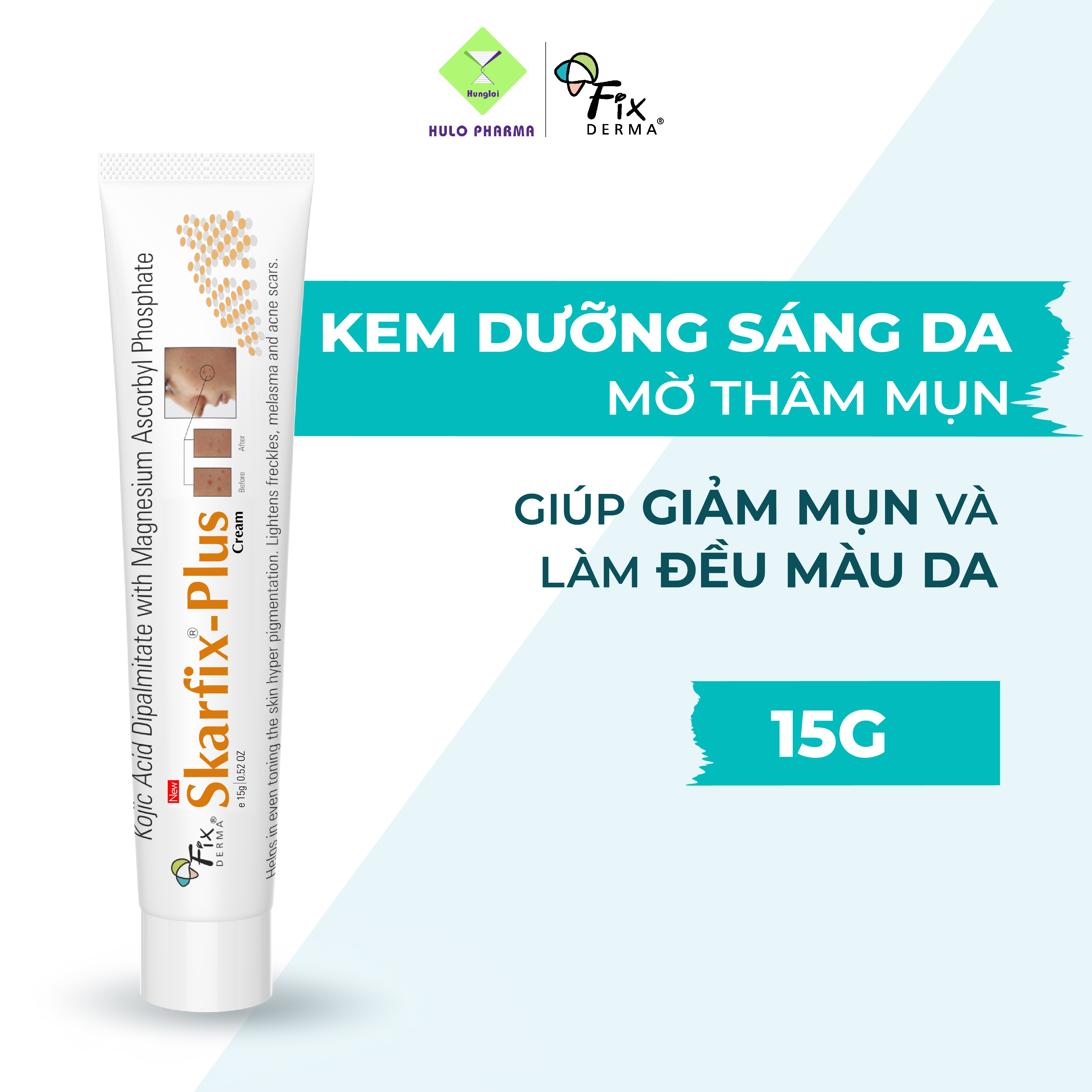 Kem Dưỡng Trắng Da Mặt, Mờ Thâm Mụn, Nám FIXDERMA Skarfix Plus Cream Giúp Giữ Ẩm, Sáng Da, Đều Màu Da 15g [Hùng Lợi]