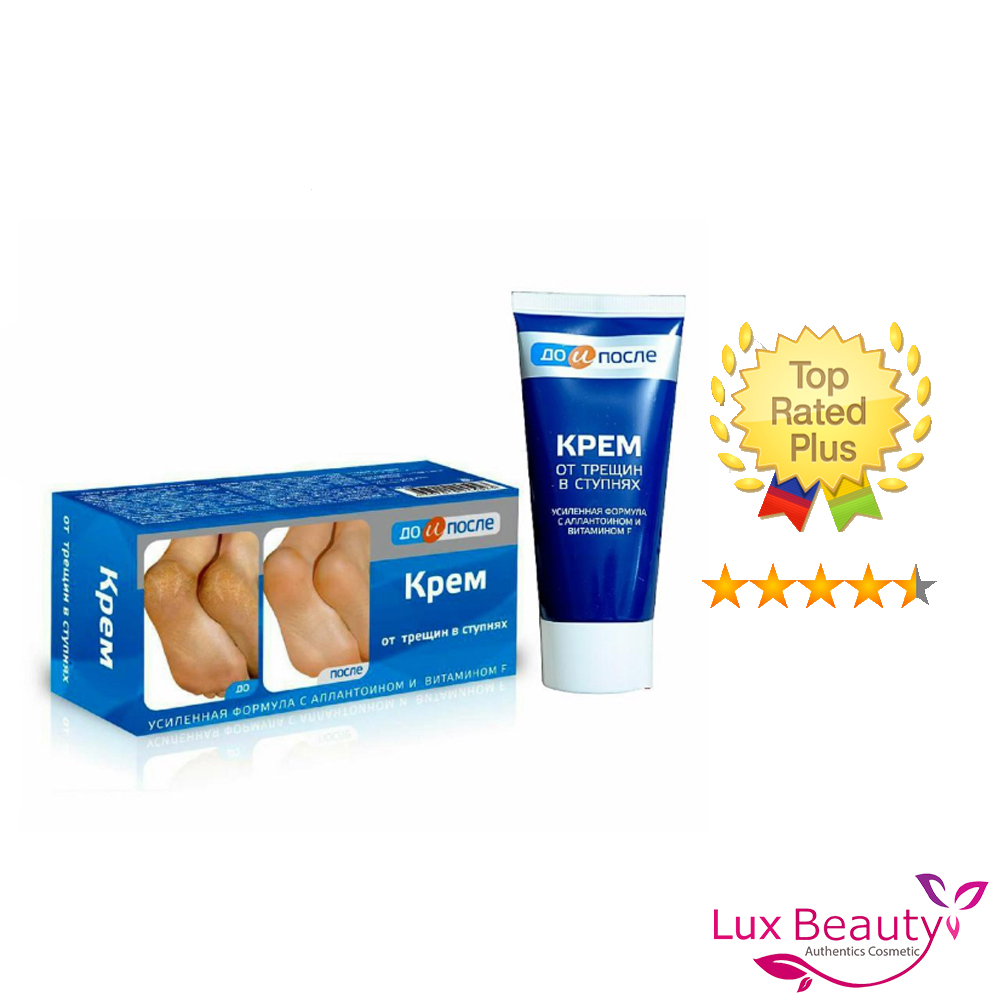 Kem Nứt Nẻ Gót Chân Nga Kpem