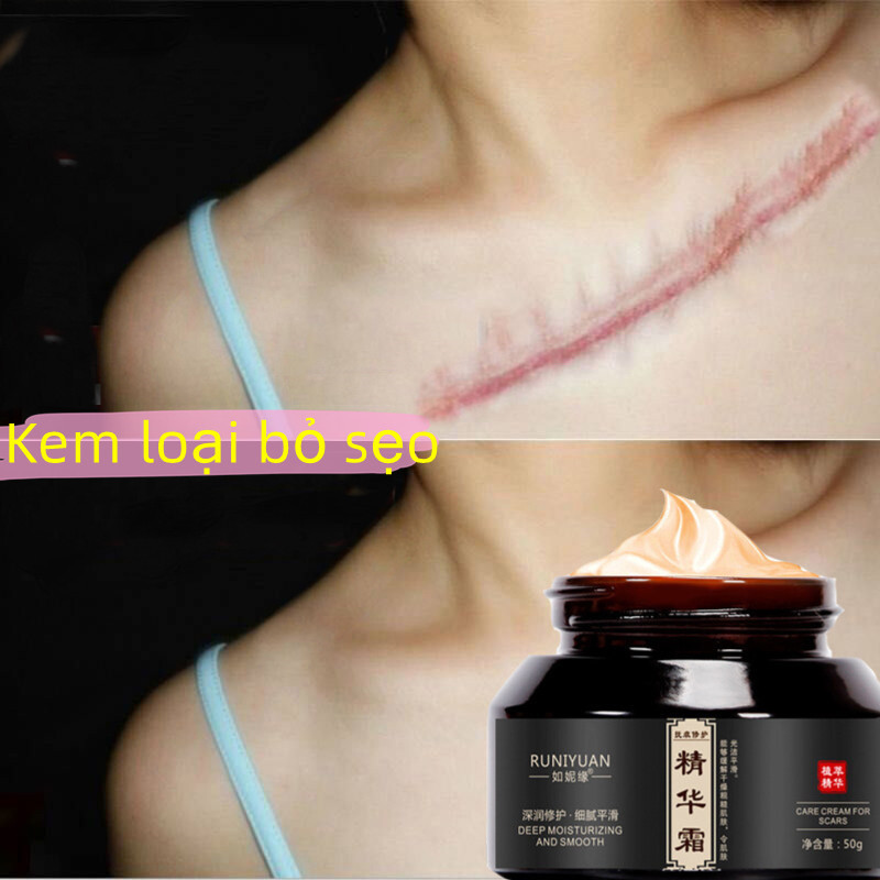Kem xóa sẹo Kem phục hồi sẹo kem chăm sóc sẹo 50g chuyên xóa sẹo lồi lâu năm xoá sẹo bỏngsẹo mụnsẹo trầy xước.mờ sẹo thâm mụnmờ thâm khổi phục da nhanh chóng hiệu quả nhanh chóng không tác dụng phụ