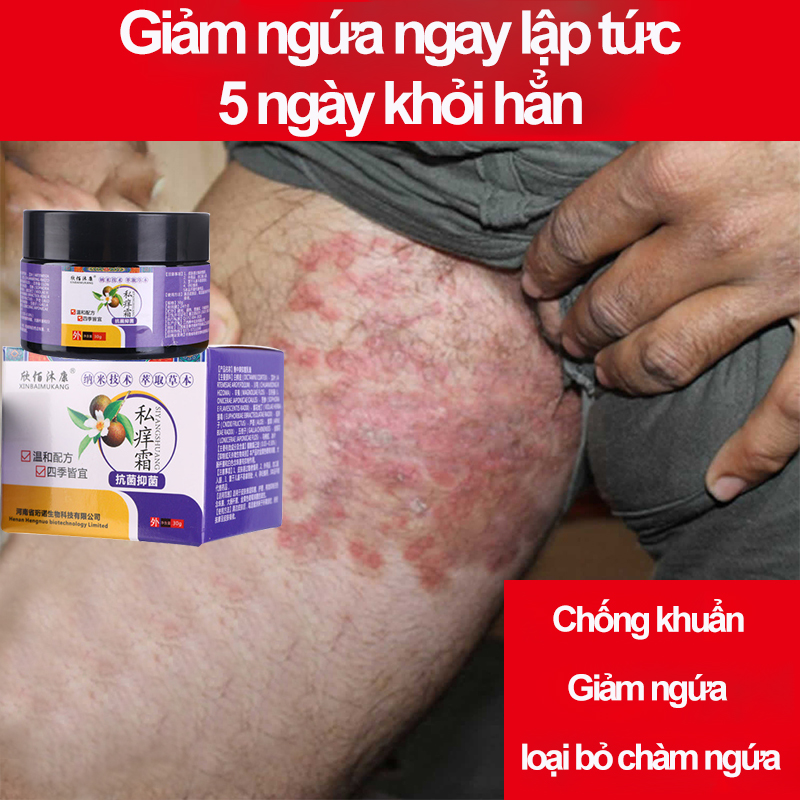 Kem bôi ngứa vùng kín cho nam và nữ kem chống ngứa quanh hậu môn Phụ Khoa Viêm Nhiễm Nấm, Ngứa Vùng Kín bên trong đùi,Ngứa bìu Nấm vùng kín Nam Nữ Dùng Được 30g