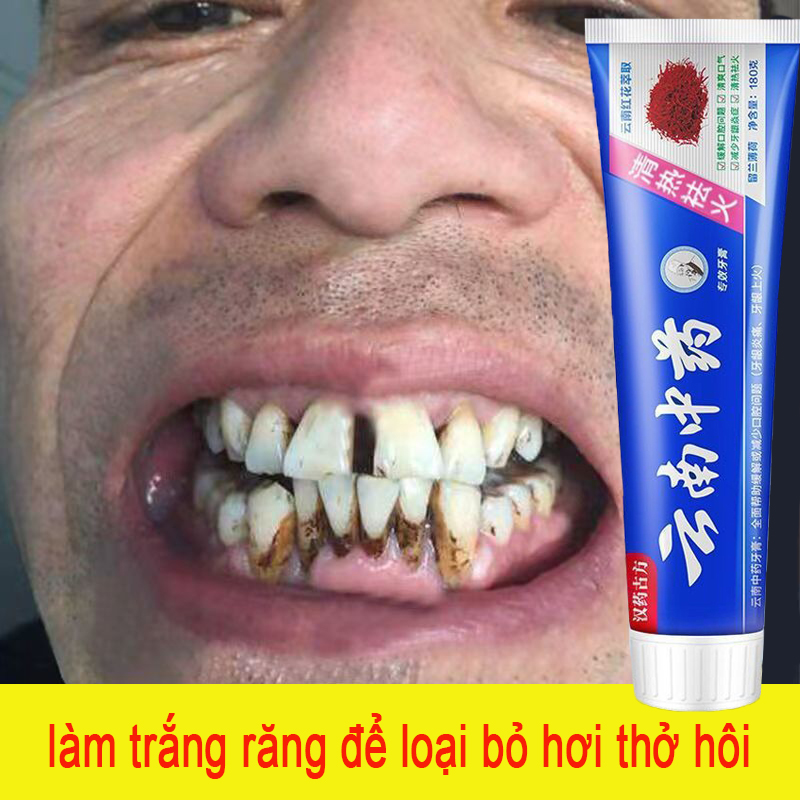 Kem đánh răng làm trắng răng Ngăn ngừa hôi miệng Kem đánh răng 180g Giảm sâu răng Chảy máu Kẹo cao su Loại bỏ cao răng Hôi miệng Làm trắng răng Làm trắng răng Trung Quốc Dược thảo kem đánh răng，Unisex