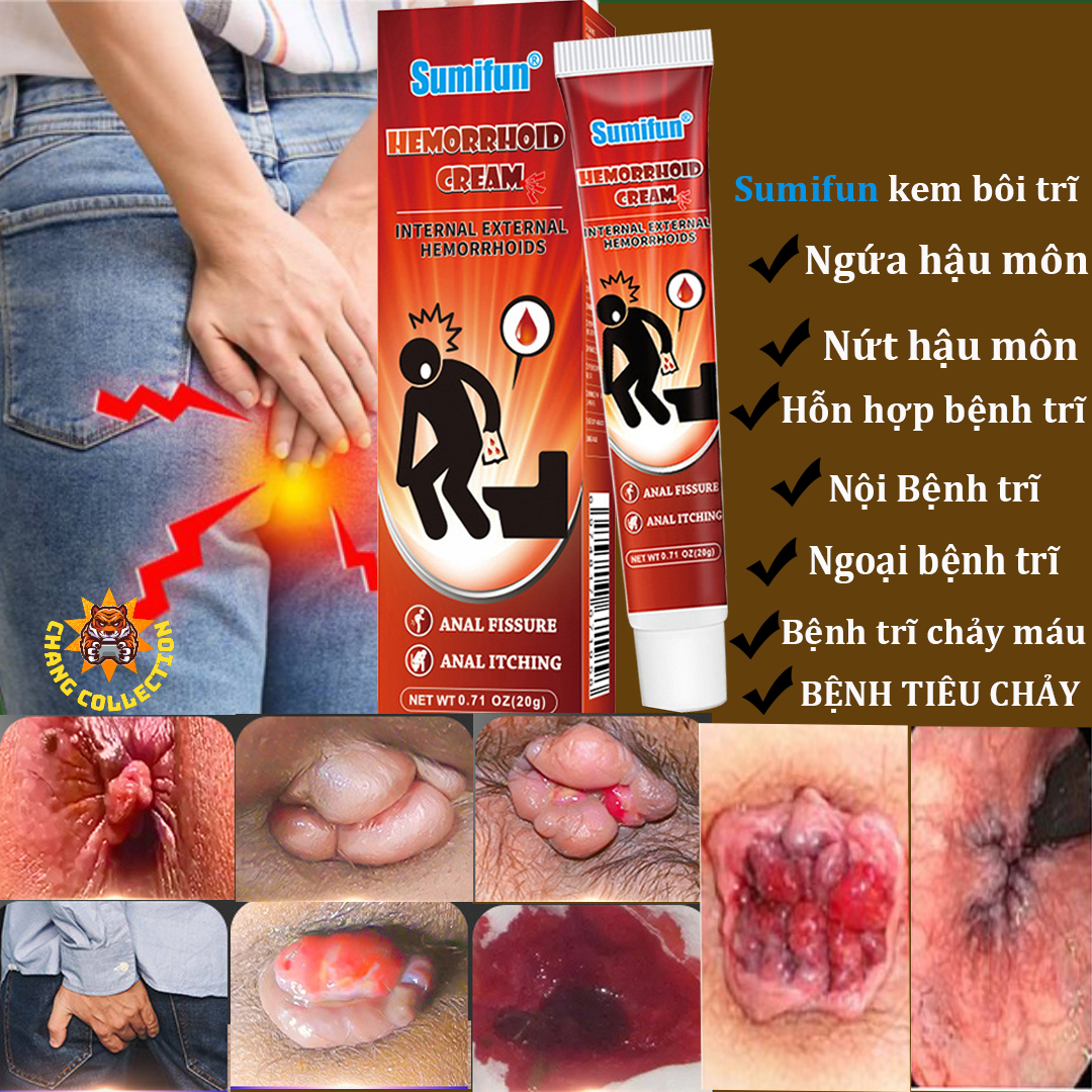Kem bôi trĩ Gel trĩ Kem trĩ Kem bôi teo búi trĩ 20g Dùng khi bị trĩ, trĩ nội trĩ ngoại táo bón và rát hậu môn