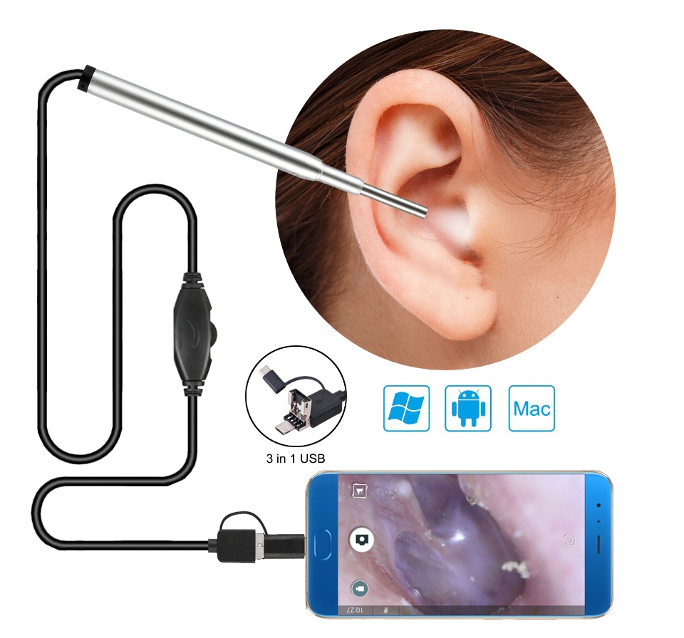 [HCM]Cây lấy ráy tai có đèn soi kết nối điện thoại máy tính cao cấp LOẠI TỐT