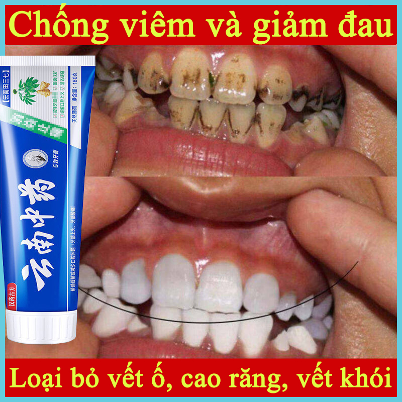 Kem đánh răng trắng răng làm trắng răng Đánh Tan Vôi Răng Loại Bỏ Ố Vàng Do Hút Thuốc Nhanh làm trắng Chống Sưng Nướu Răng Ngăn Ngừa Hôi Miệng【180g】Miệng khử hôi miệng kem đánh răng