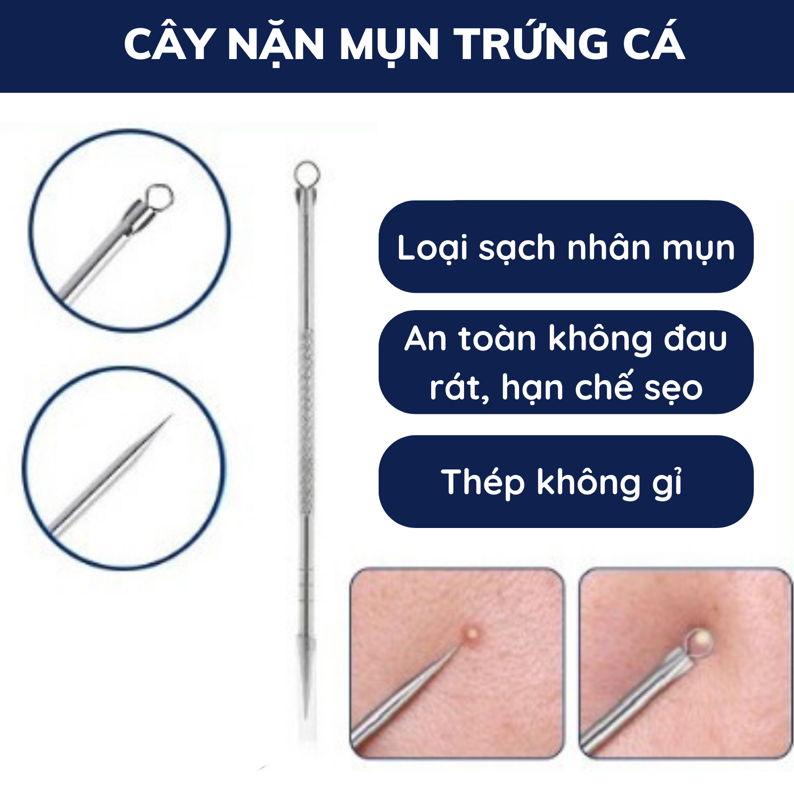 Cây lấy nhân mụn, loại bỏ mụn, thép không gỉ