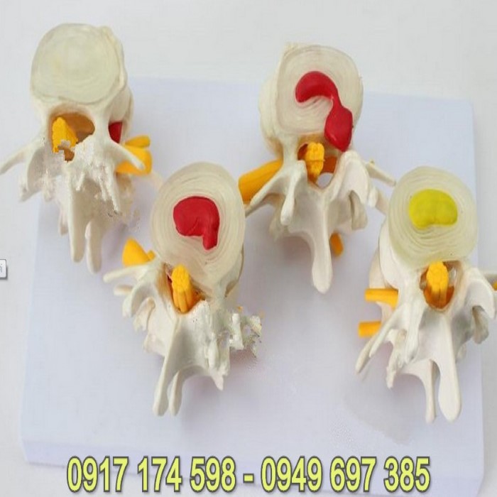 Mô hình nghiên cứu đốt sống bình thường và bệnh lý