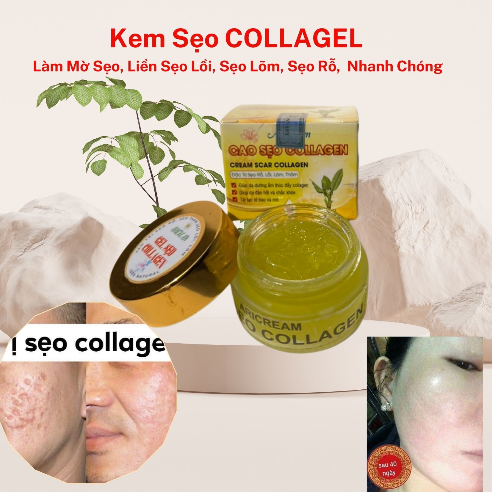 Sản phẩm Kem Sẹo Kem Sẹo Thâm Rỗ Collagen Tươi Khắc Tinh Của Sẹo Liền & Cải Thiện Sẹo rỗ lõm lồi nhanh chóng-thảo dược thiên nhiên