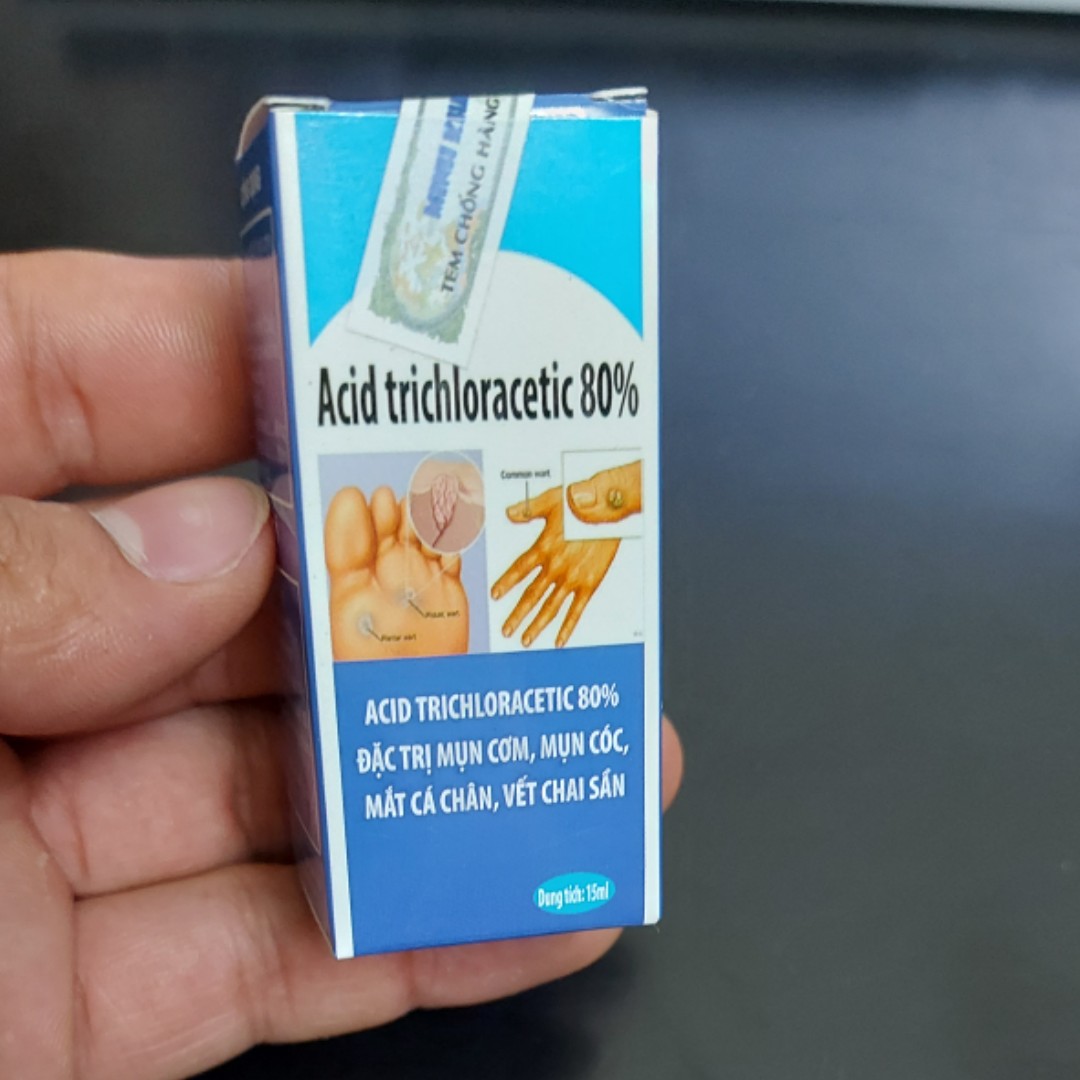 Mụn cơm, mụn cóc, vết chai sần mắt cá chân lâu năm lọ 15ml