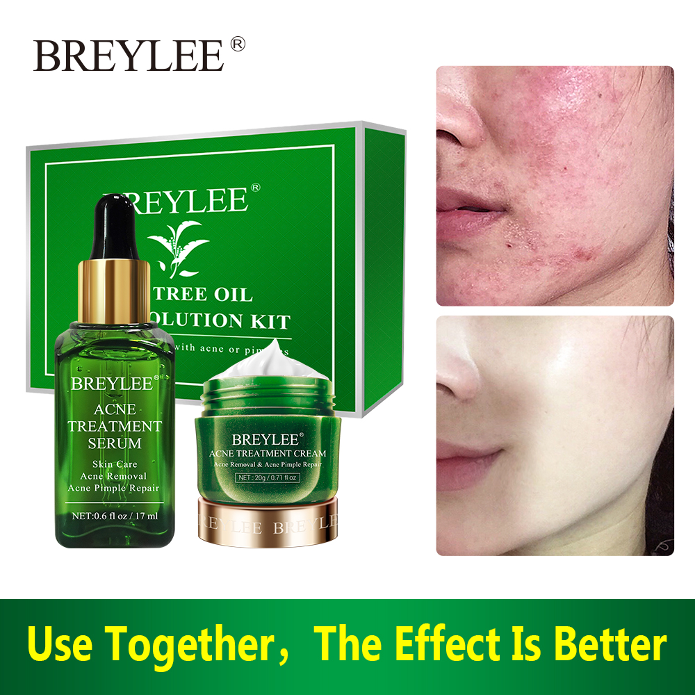BREYLEE Acne Solution Set Acne Treatment Serum Cream Spots Pimple Removal