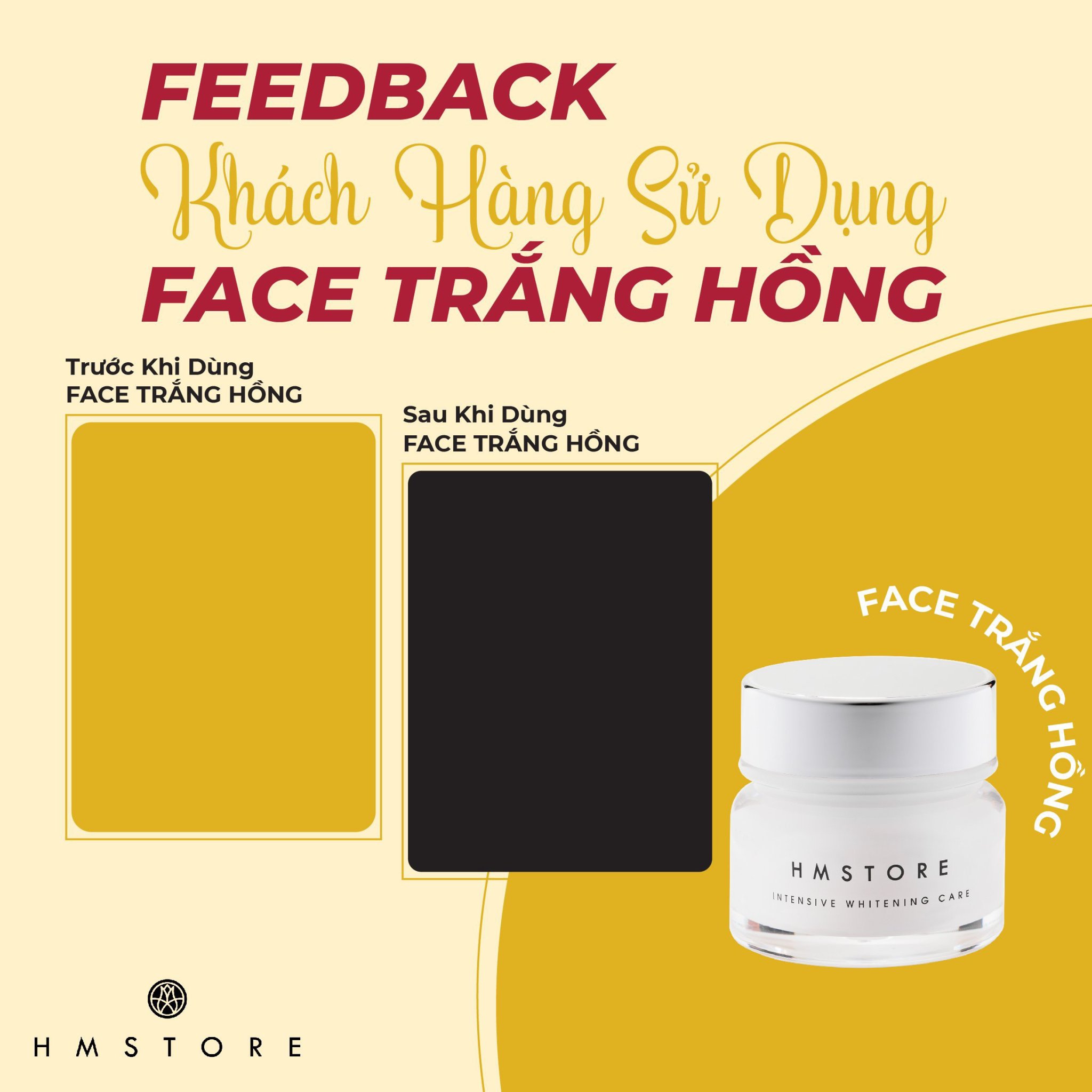 Kem face trắng hồng căng bóng h&m store