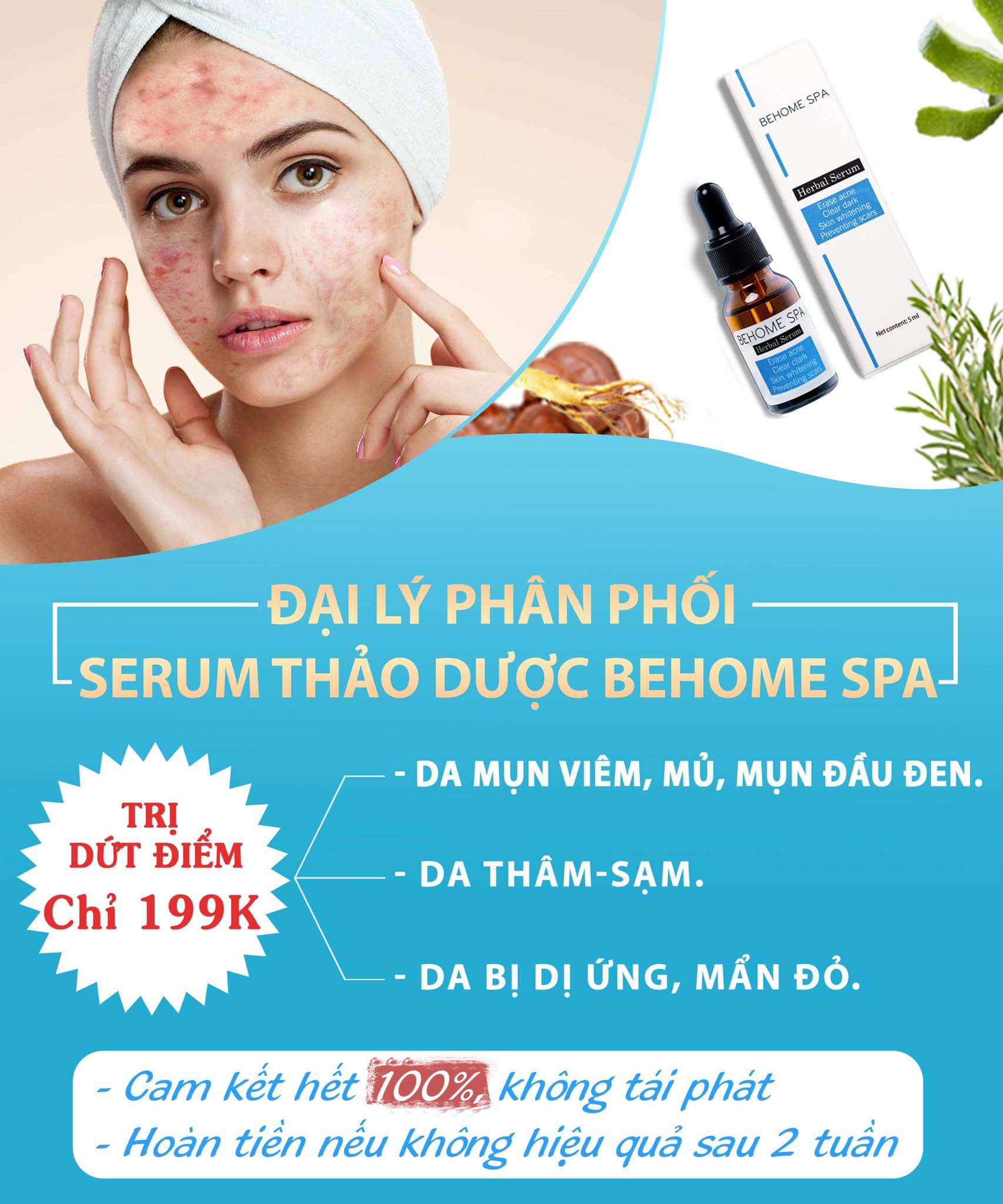 SERUM THẢO DƯỢC BEHOME SPA/ SERUM TR.Ị MỤN THẢO DƯỢC/ 5ml-1 chai