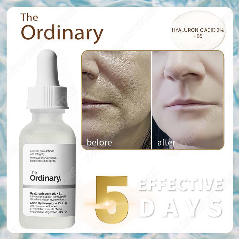 The Ordinary Cấp ẩm hồi phục Hyaluronic Acid 2% + B5 - Serum The Ordinary dưỡng ẩm da mặt chính hãng