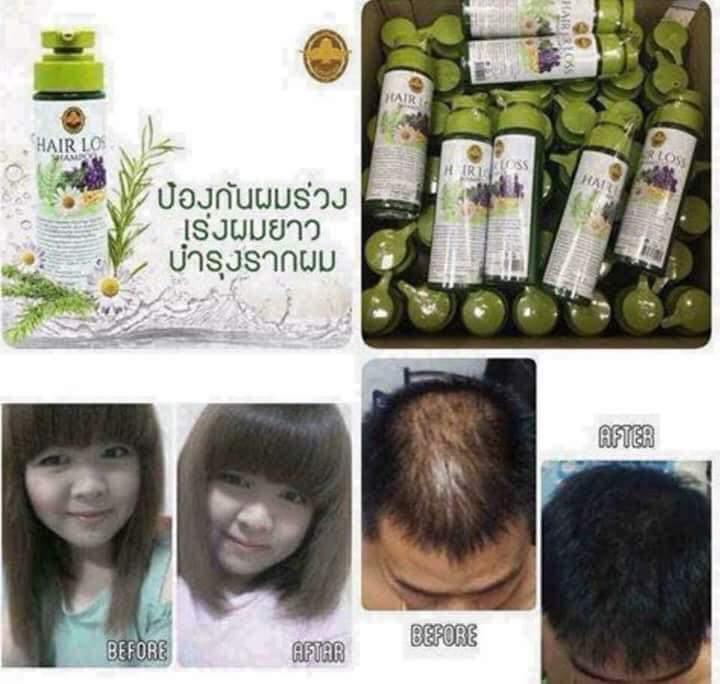Dầu gội kích thích mọc tóc số 1 tại Thái