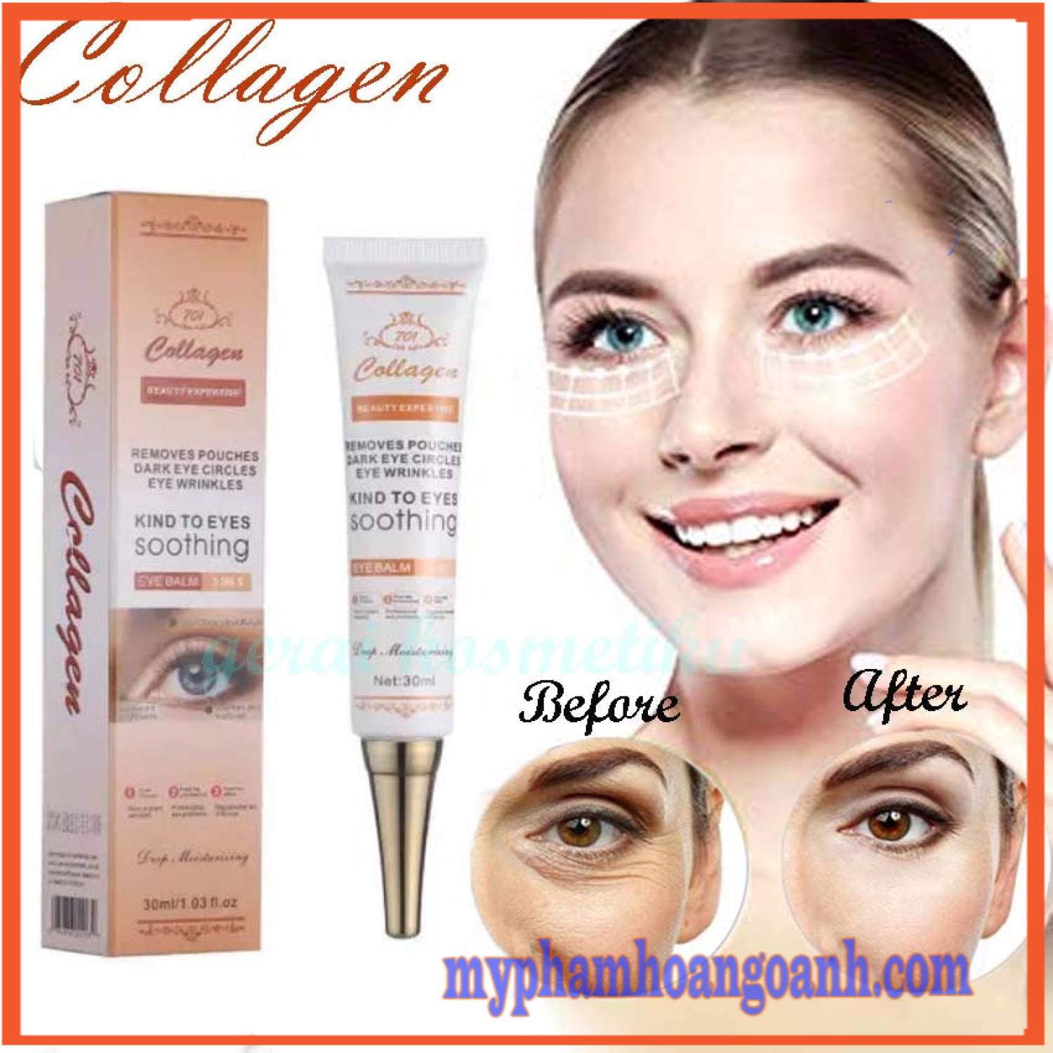 Kem TrI Thâm Mắt Collagen 701