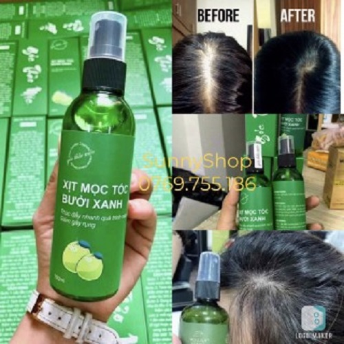 CHAI XỊT MỌC TÓC BƯỞI XANH, KÍCH THÍCH MỌC TÓC HIỆU QUẢ SAU 2 TUẦN 100ML