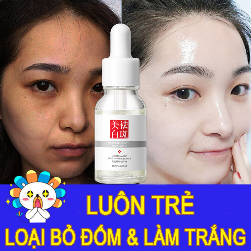 Tinh chất làm trắng15ml Kem diệt tàn nhang Loại bỏ các đốm đen, bạch biến, nám, đốm tàn nhang, đốm đồi mồi và các đốm da khác trên khuôn mặt Chống lão hóa làm trắng sáng nuôi dưỡ