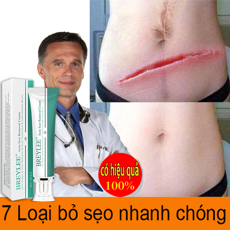Kem sẹo chăm sóc sẹo giảm sẹo mụn kem mụn phục hồi sẹo rỗ sẹo thâmvết bỏng làm mờ vết rạn da khi mang thai unisex
