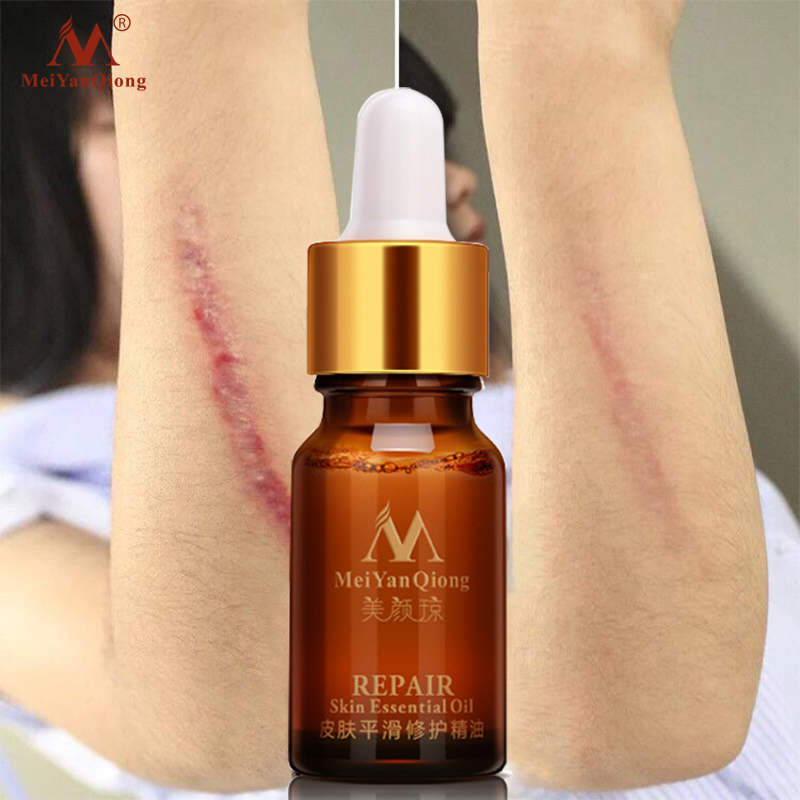 MeiYanQiong Tinh dầu dưỡng chất làm mờ sẹo mờ vết rạn da bằng tinh chất hoa oải hương tinh khiết chăm sóc da tự nhiên - INTL