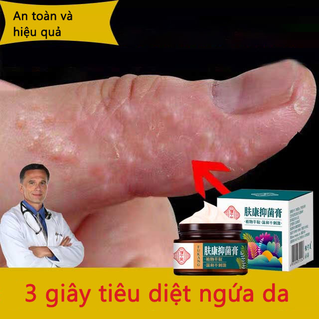 Kem chống ngứa FUKANGBAICAO, kem chống khuẩn chống viêm và ngứa da, thuốc mỡ loại vẩy nến, nấm ngoài da, phát ban và ngứa da