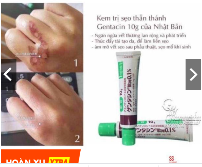 Kem sẹo Gentacin Nhật Bản 10gr