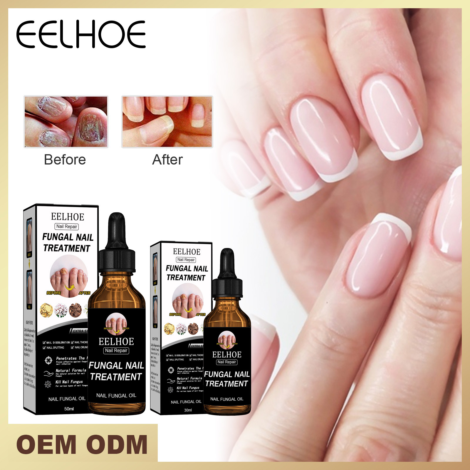 Serum Eelhoe trị nấm móng tay chân, tinh chất dưỡng móng chính hãng lọ 30ml