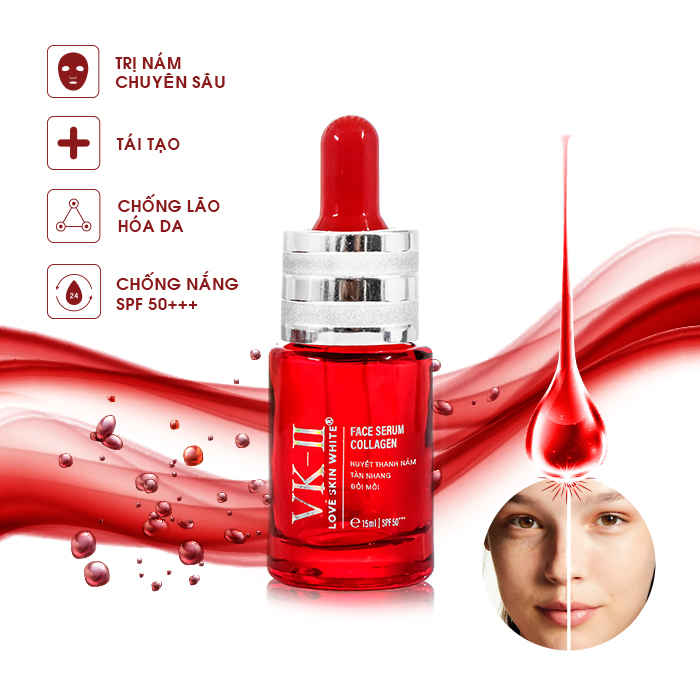 Serum trị Nám – Tàn Nhang – Đồi Mồi VKII 15ml