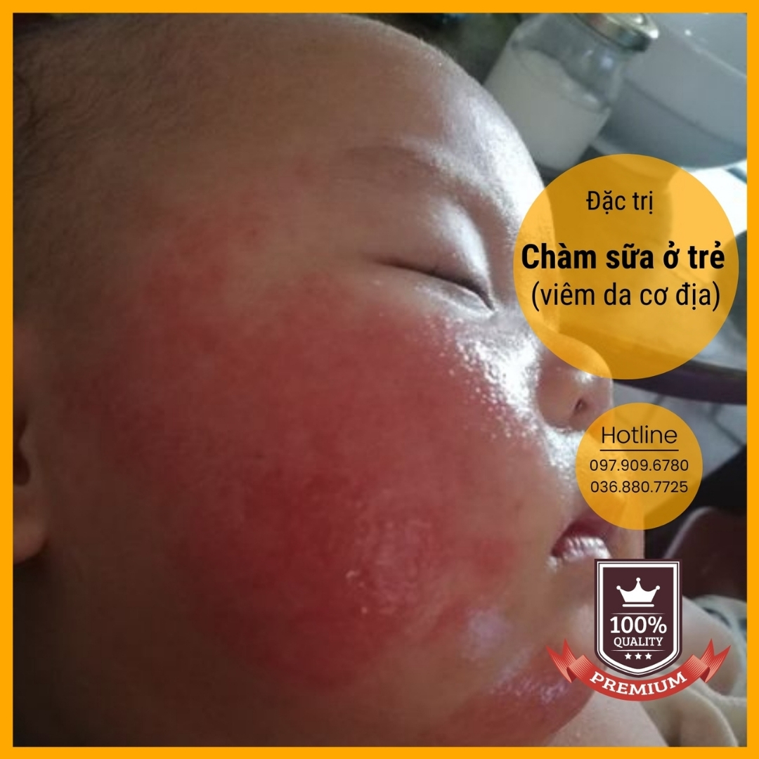 Dung dịch Anolyte KT (Nước A - Combo 3 chai 1,5lit)