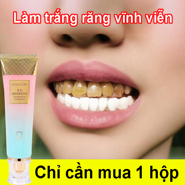  làm trắng răng 7 ngày,Kem đánh răng làm trắng nhanh chóng hết ố vàng cao răng khử mùi hôi miệng giảm viêm loét miệng chăm sóc nướu Chăm sóc răng miệng cho người lớn Đàn ông và Phụ nữ 