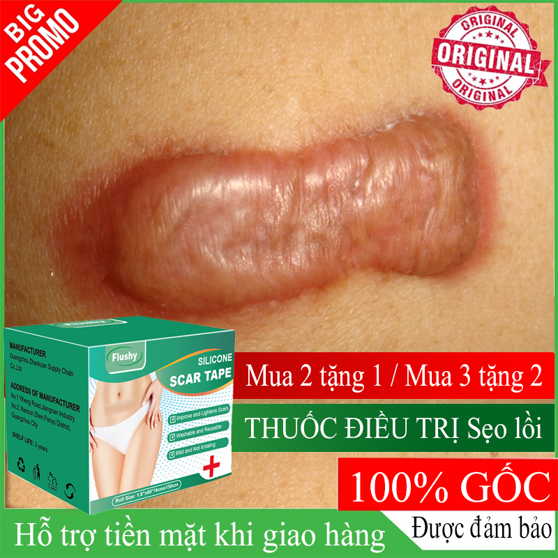 miếng dán che sẹo Miếng Tấm Dán Mờ Sẹo Lồi sẹo thâm dán xóa mờ sẹo