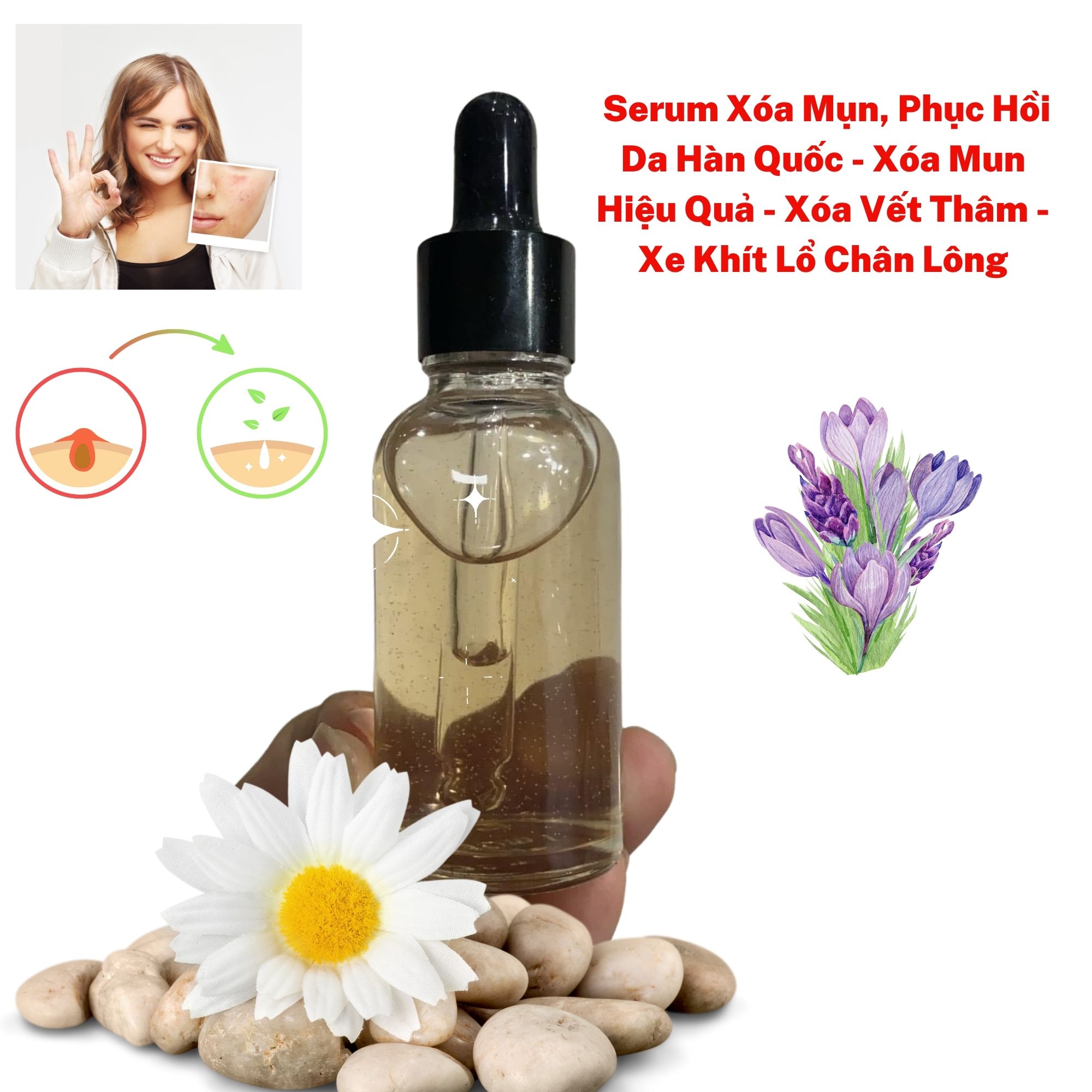 Serum xóa mụn, phục hồi da 10ml hàn quốc - xóa mun hiệu quả - xóa vết thâm - xe khít lổ chân lông - sunnary cosmetics