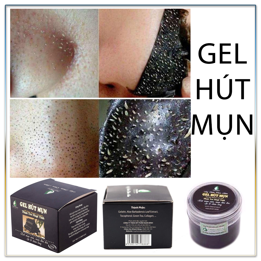 Gel Lột Mụn Than Tre Hoạt Tính Hút Tận Gốc Bụi Bẩn, Mụn Cám, Mụn Trứng Cá, Mụn Đầu Đen Tặng Kèm Mặt Nạ Dưỡng Da Ngân Bình