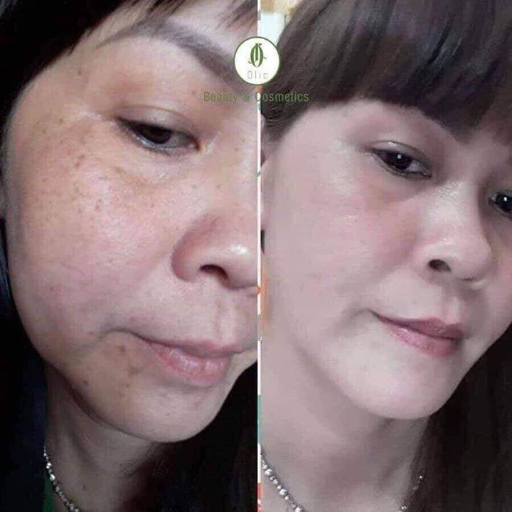 Kem sâm đế vương dưỡng da mờ nám